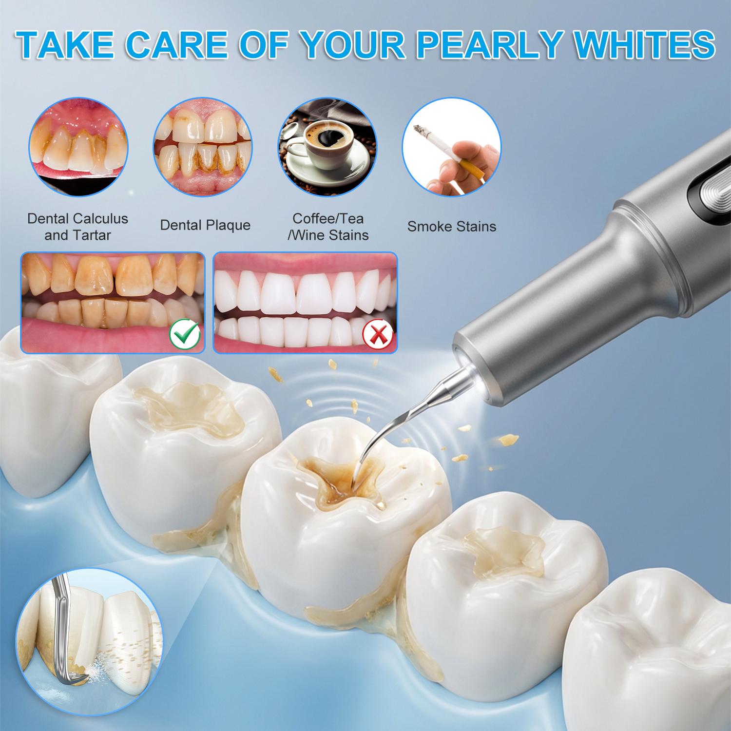 Plaque Remover for Teeth Dental Calculus Remover Teeth Cleaning Kit with Dental Tools 5 Smart Modes Cleaning Tools for Home Travel Business Pet Shop