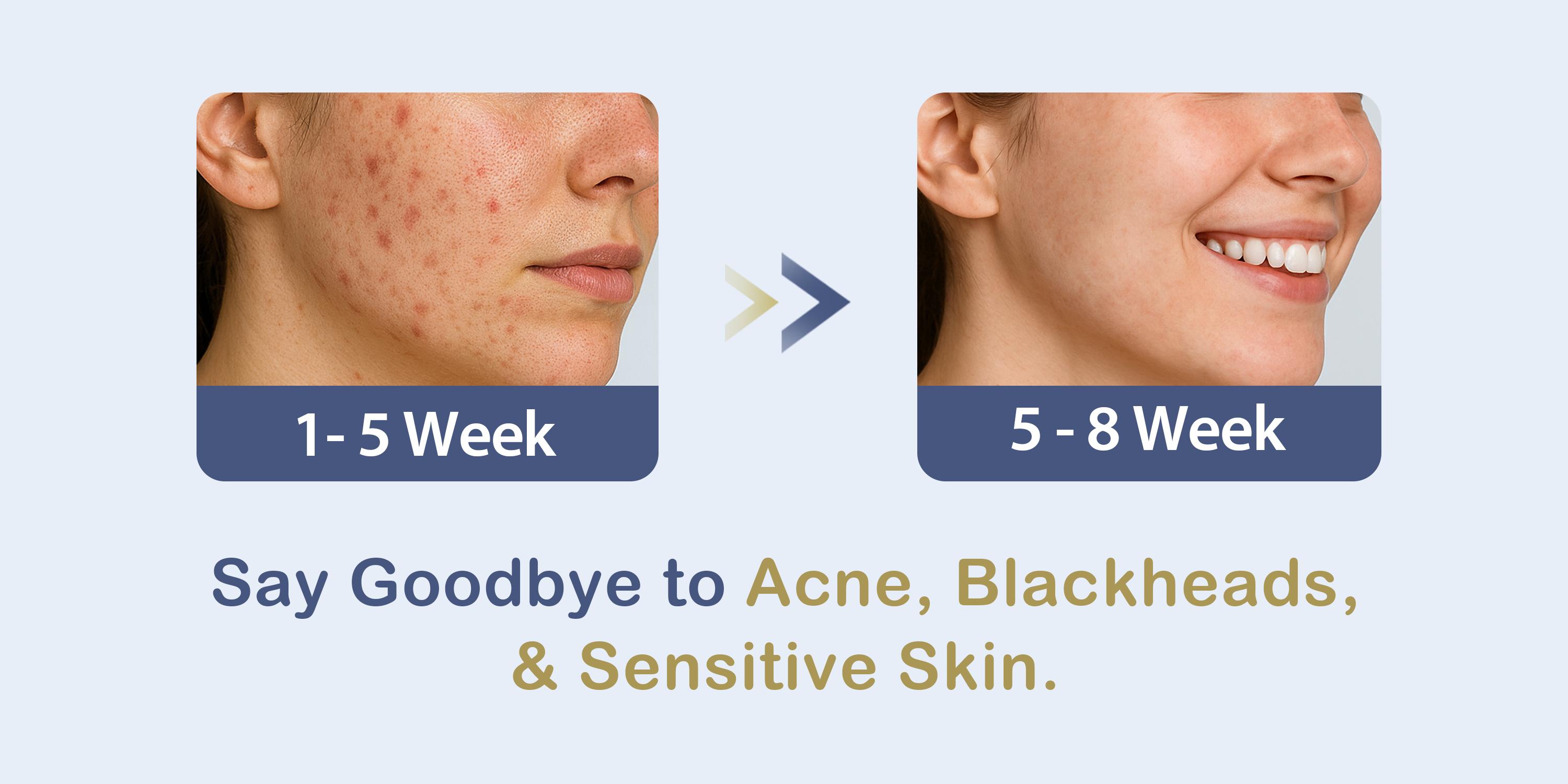 Ourmed Life Disposable Compressed Towel Tablets, Individually Wrapped Cleaning Face Towels, Quick-Expand with Water, Soft & Lint-Free, 12"x10" Bagged/boxedTravel Washcloths for Camping,Hiking & Backpacking (112/100/56 Count) Ourmed Life Disposable Compressed Towel Tablets, Individually Wrapped Cleaning Face Towels, Quick-Expand with Water, Soft & Lint-Free, 12"x10" Bagged/boxedTravel Washcloths for Camping,Hiking & Backpacking (112/100/56 Count)