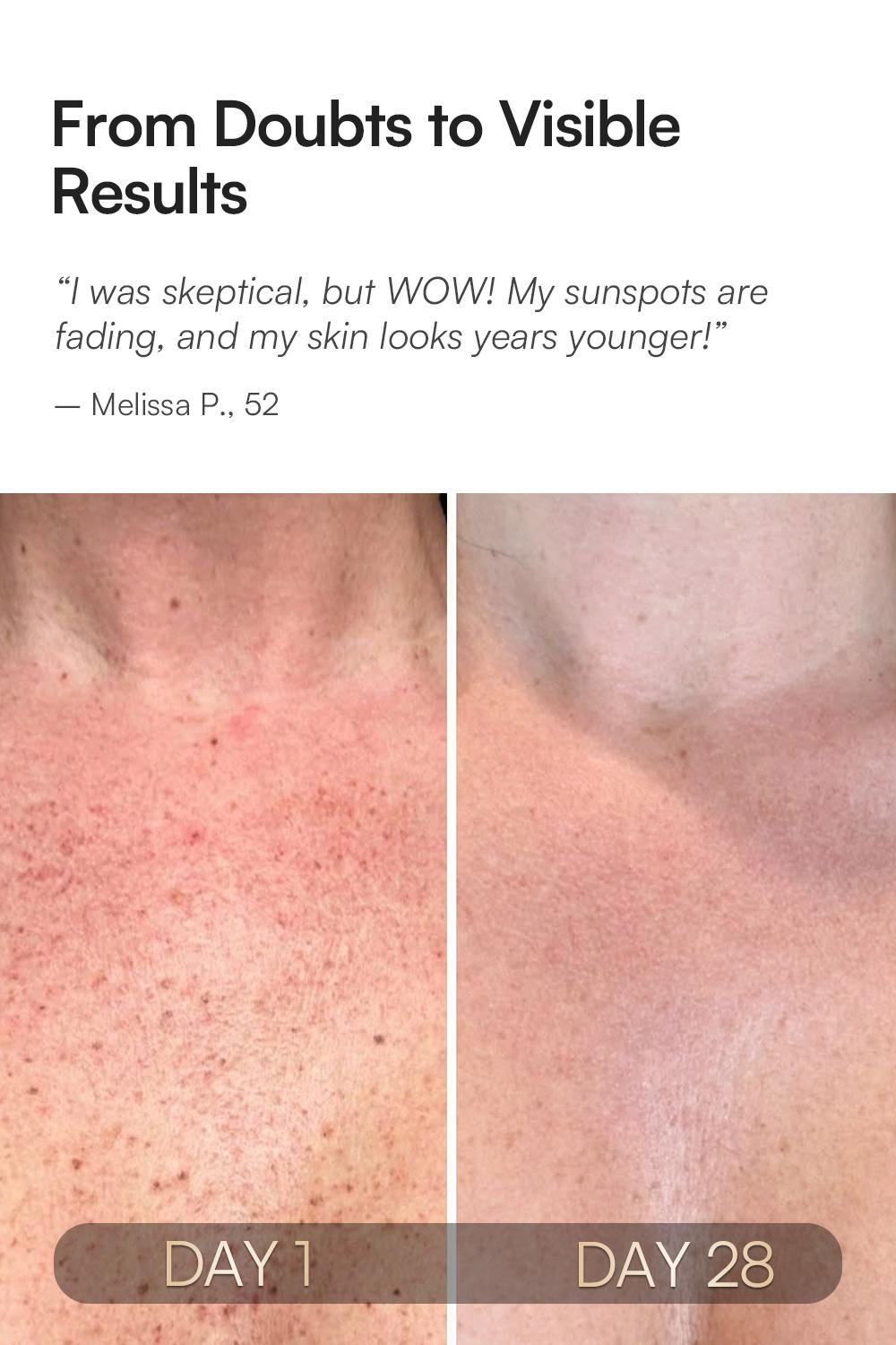 INIA GLOW Neck & Chest Red Light Mask – 850nm NIR LED Mask for Wrinkle & Spot Reduction, Lift & Firm in 4 Weeks, Rechargeable 2600mAh Controller, Clinic-Grade Full Coverage, Best Valentine's Day Gift for Her