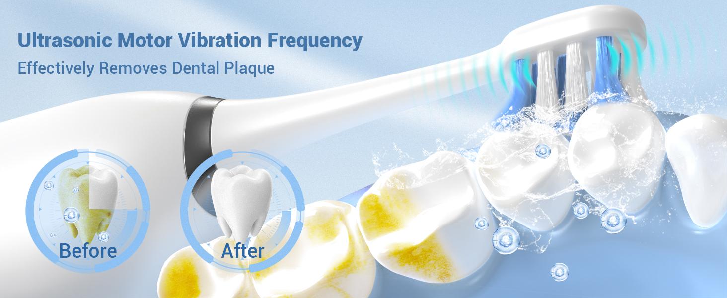 Portable Detachable Electric Toothbrush with Water Flosser, Washing & Care 2-in-1, Wireless Water Flosser Tooth Cleaning Kit 2.0, Combo IPX7 Waterproof Rechargeable Oral Irrigator, Suitable for Family Travel, Oral Health Gift Recommendation