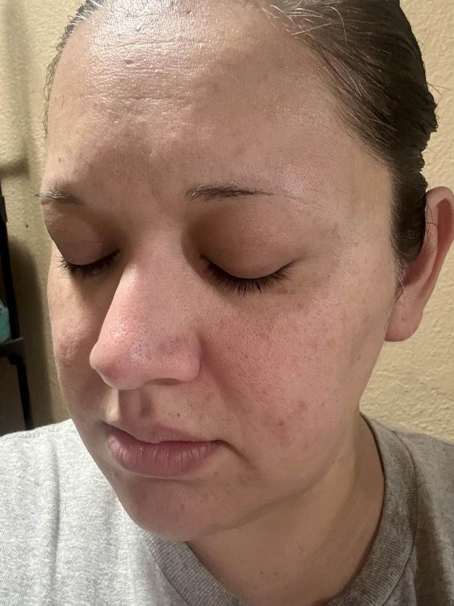 Item: Peel Shot Duo Set(white rice+ black rice)