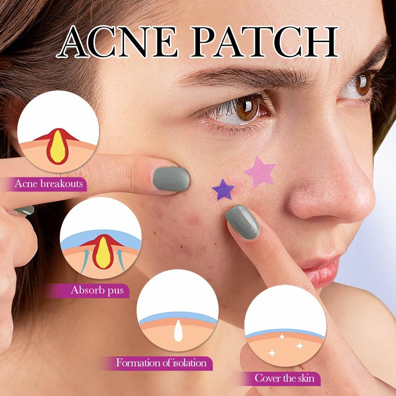 【156PCS】Star Shaped Hydrocolloid Acne Patch,Suitable for All Skin Types,Waterproof Acne Cover Patches, Repair and cover acne blemishes,Blemish Patches,Alcohol-Free Sensitive