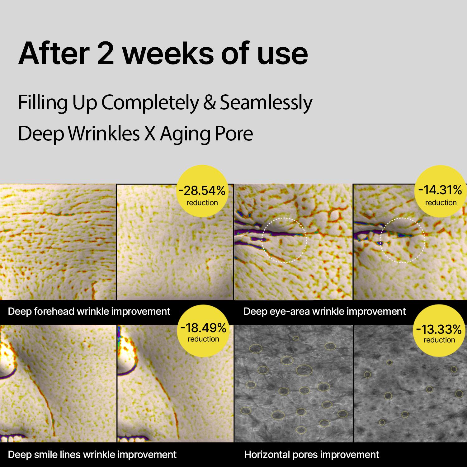 [celimax official] The Vita A Retinal Shot Tightening Booster | with Retinal, Matryxyl, Pore Minimizer, Wrinkles & Fine Lines, Firmer Skin, 15ml, Retinol Skincare