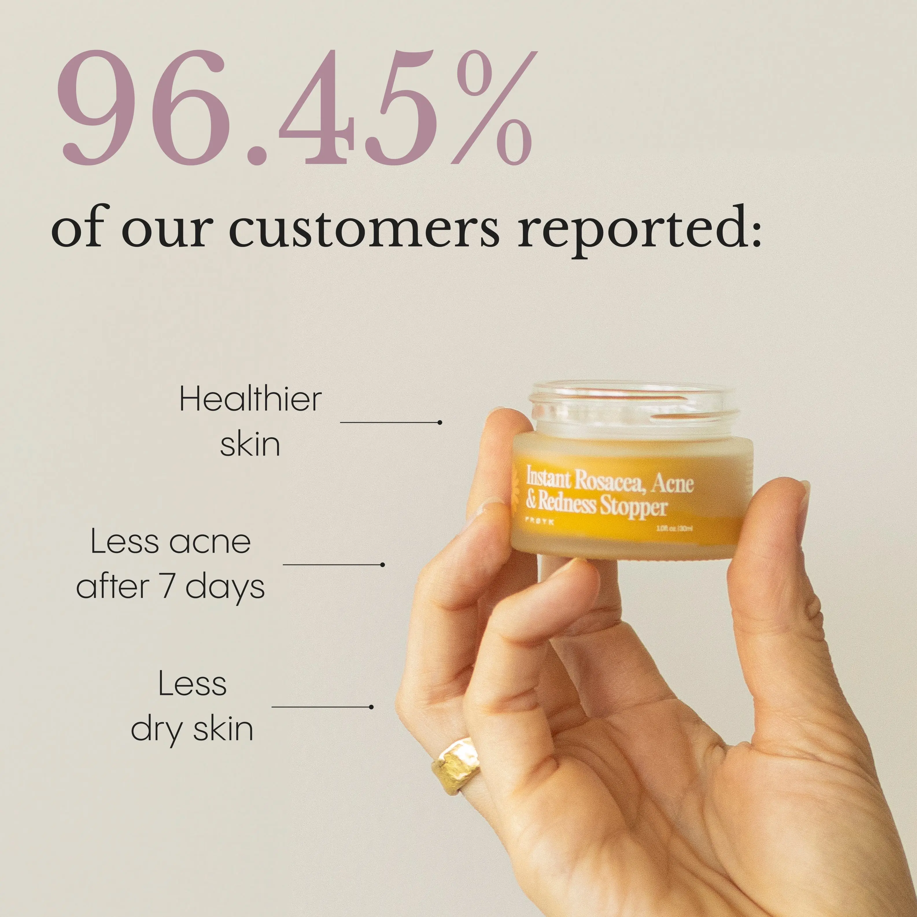 The Complete Acne System for Women Blemish Relief Care Pore Remover