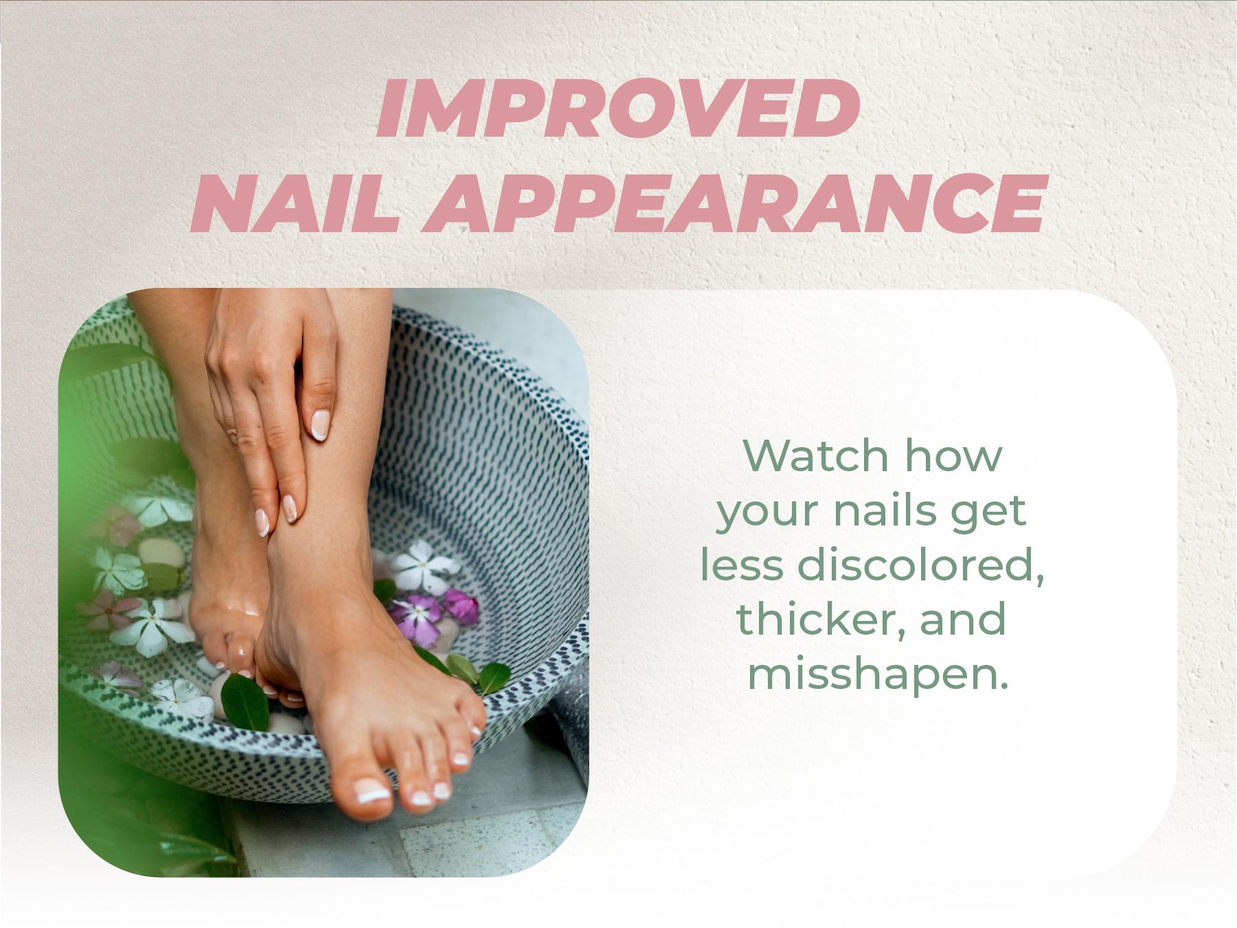 Fungus Eliminator Dietary Supplement – Nail & Foot Support for Clearer, Healthier-Looking Nails