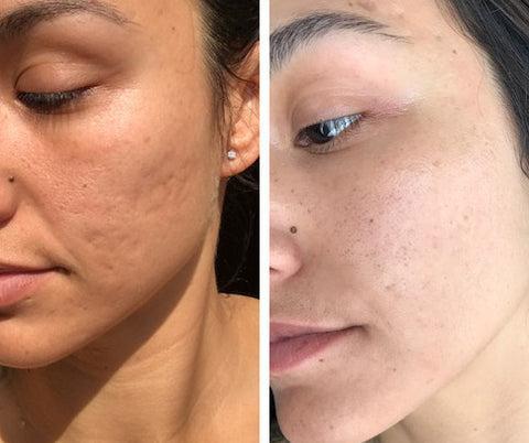 DRMTLGY Advanced Retexturizer 2oz with 15% Glycolic Acid