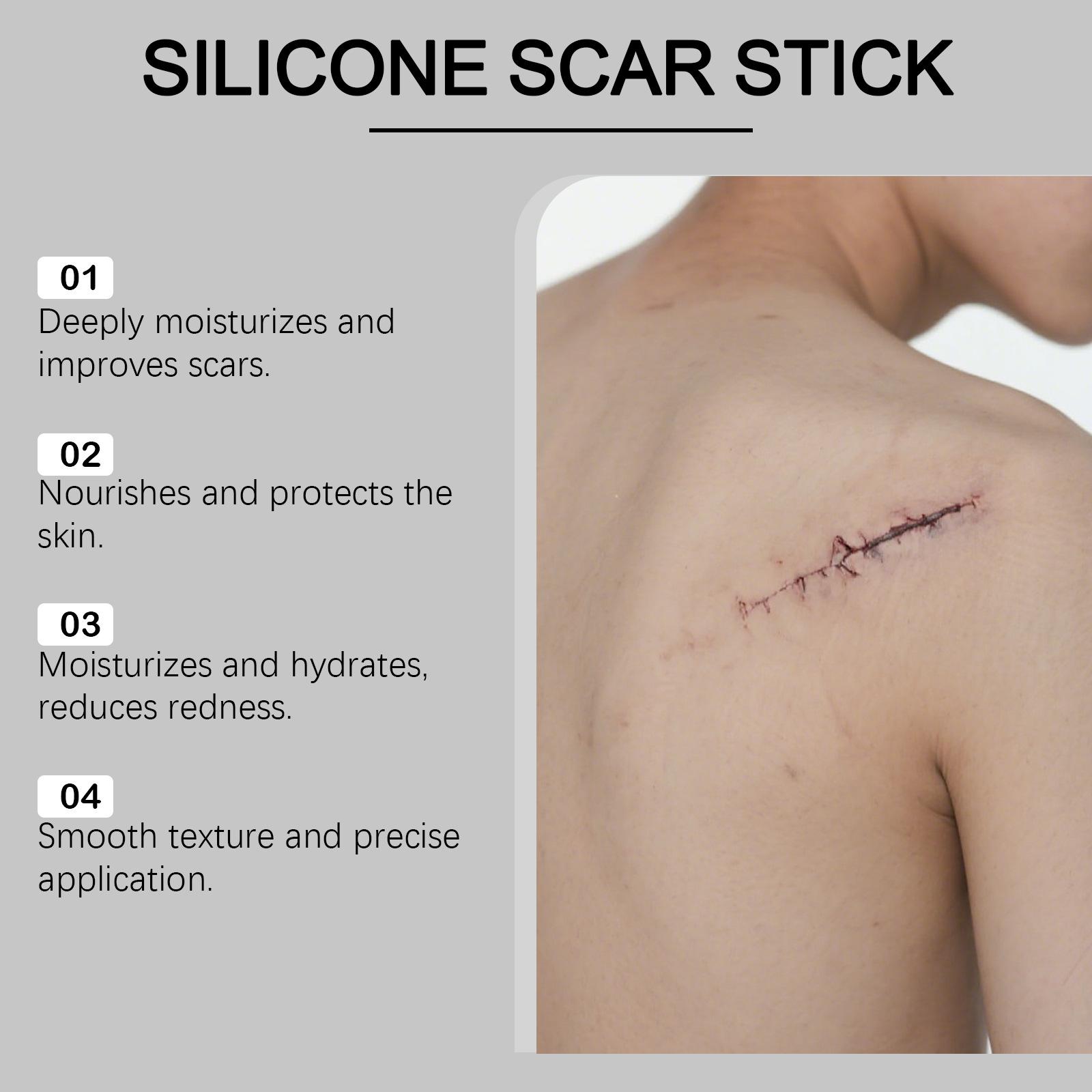 Scar Solutions Silicone Scar Stick for Face and Body 60% Soothing Moisturizing Gentle on All Skin Types Easy-to-Use Stick Design 6g
