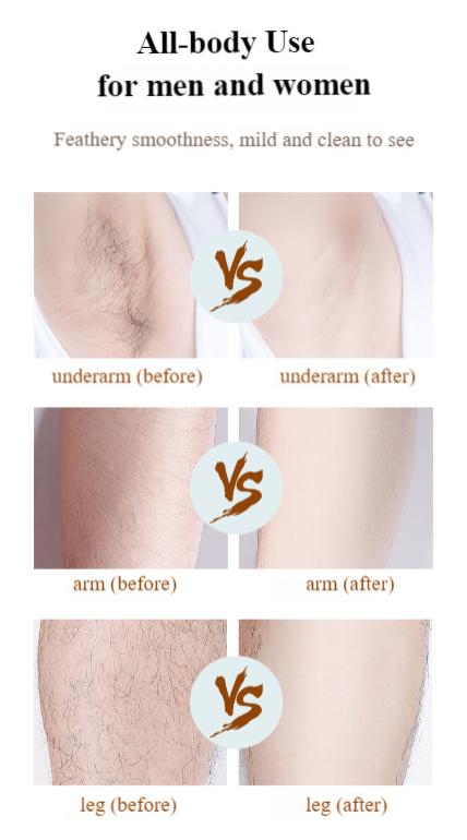 SEALIGHT 2 in 1 Shaver, Wet-Dry Usable Electric Shaver, USB Rechargeable, Hair Removal for Face, Legs, Cordless Waterproof Trimmer with Head Base, Painless Epilator, remington shaver, shaver for men #springtok