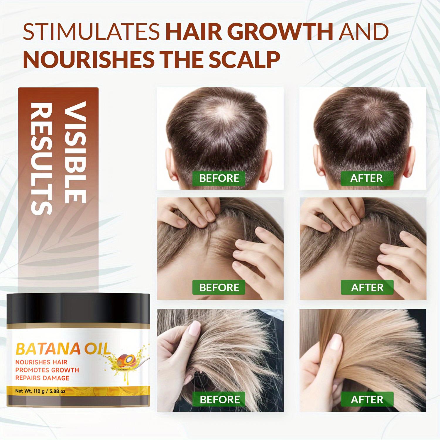 Batana Hair Growth Oil  Moisturize & Strengthen – Perfect Valentine’s Gift, Prevent Hair Loss, Restore Dry Damaged Hair 110g / 3.88oz