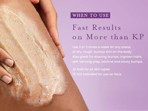 Elvira KP Bump Eraser Foot & Body Scrub, Exfoliating Scrub for Keratosis Pilaris, Smooth Skin with 10% AHA BHA & Niacinamide, Deep Moisturizing Cleanser for All Skin Types, Exfoliante para el Cuerpo