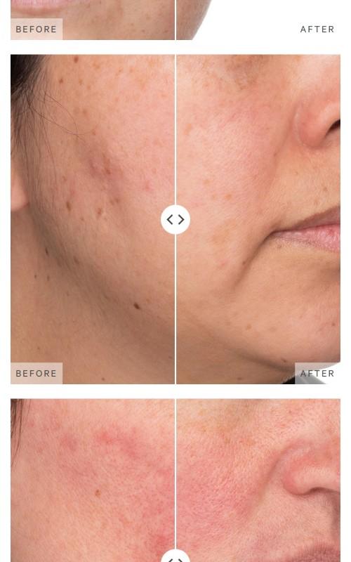 Turmeric Brightening & Exfoliating Scrub + Mask