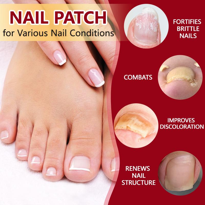 Lansiyi Nail Patches 21pcs/box with 5 Herbs for Nail Problem Care Matte Japanese Style Daily Care Nails Kit Set Lansiyi Nail Patches 21pcs/box with 5 Herbs for Nail Problem Care Matte Japanese Style Daily Care Nails Kit Set