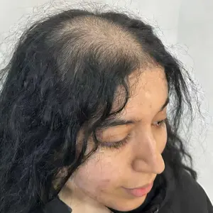 Facefly Anti Hair Loss Shampoo Bar – Sophora Flavescens Root Extract , Ginseng &  Soapberry, Strengthens Roots, Reduces Hair Fall, for Thinning Hair, Sulfate-Free, Herbal Hair Growth Soap 180g Haircare Cleansing Conditioner Biotin Hair Conditioner Bar