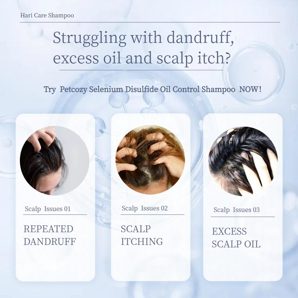2 Selenium Disulfide Hair Care Nourish Shampoo Oil Control Refreshing Anti-Dandruff Anti-itch Scalp Cleansing Shampoo Haircare Comfort Hair Growth, 300ML