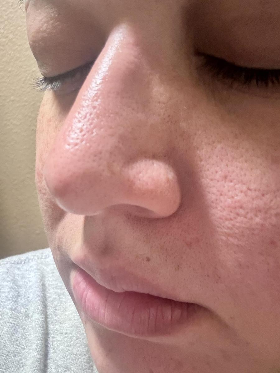 Item: Peel Shot Duo Set(white rice+ black rice)