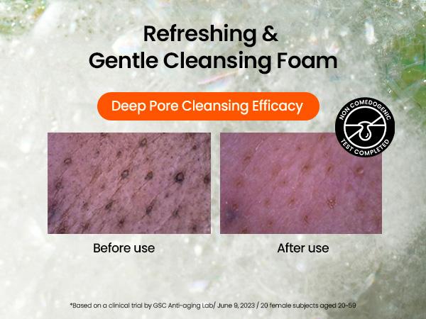 [beplain Official] Skin Detox Cleansing Foam | Korea's No.1 Mung Bean pH-Balanced Cleansing Foam 160ml | Foaming Cleanser for All Skin Types Facial Wash