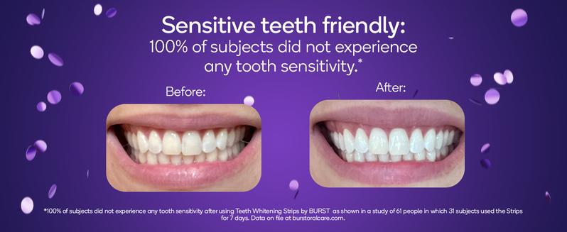 BURST Teeth Whitening Strips for Sensitive Teeth, No-Slip Grip, Dental White Strips Kit, 20 Strips, 10 Treatments, Visibly Whiter Teeth After One Use BURST Teeth Whitening Strips for Sensitive Teeth, No-Slip Grip, Dental White Strips Kit, 20 Strips, 10 Treatments, Visibly Whiter Teeth After One Use