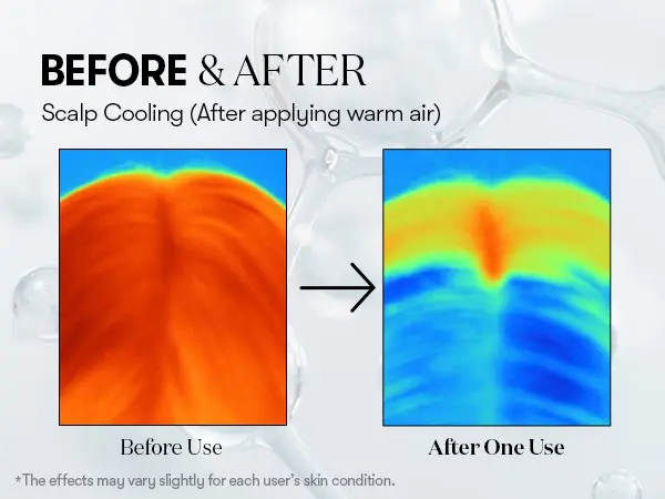 [VT COSMETICS] #1 viral PDRN Reedle Shot Hair Ampoule with Liquid Microneedling, PDRN, Caffeine, Biotin & Rosemary Extract | Hair Strengthening, Lengthening, Thickening, Baby Hair & Daily Care | Scalp, Hairline, Roots | Korean Haircare