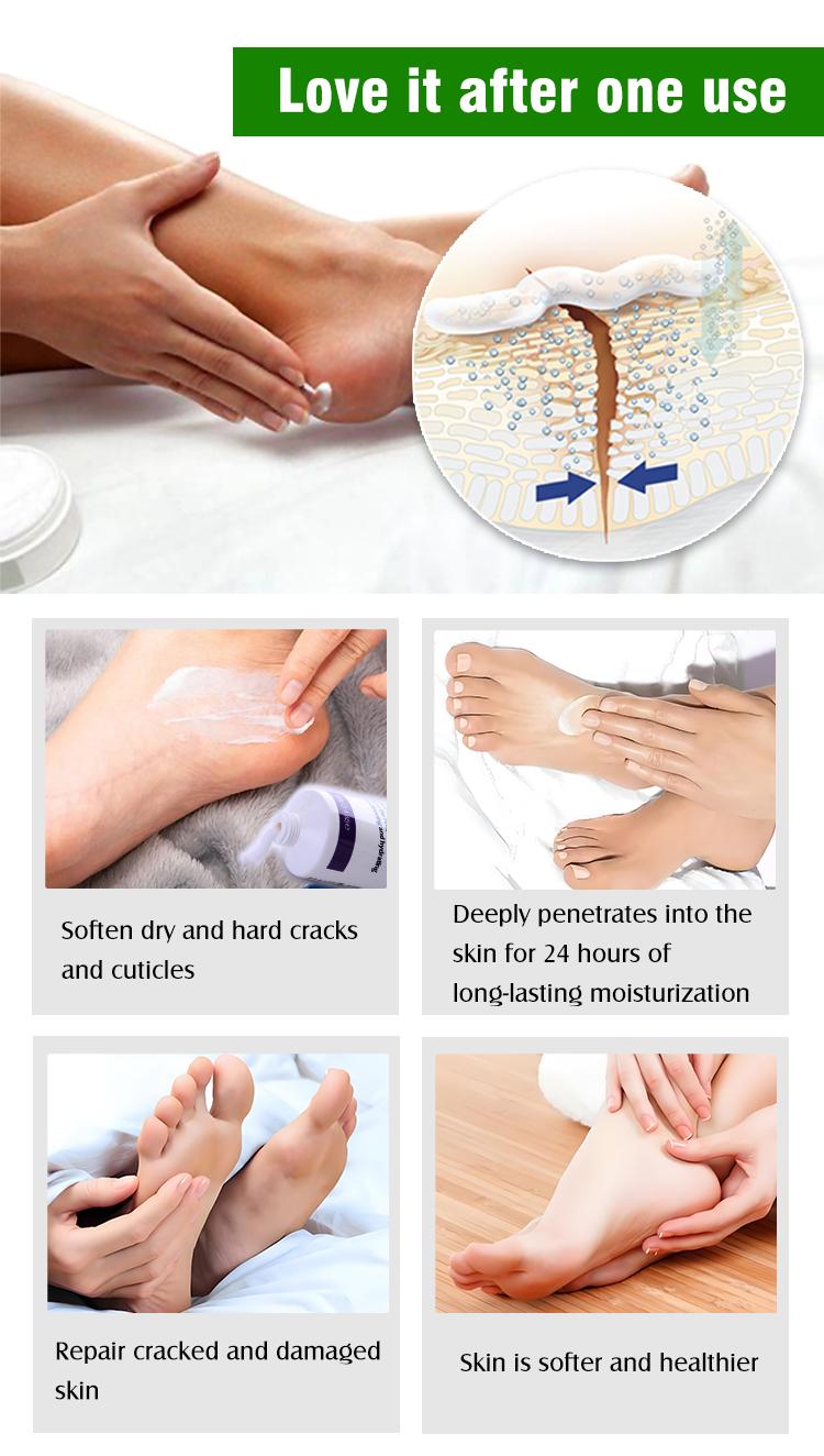 Clearzal  Dry Cracked Feet Repair UltraHydrating Hand and Foot Cream Crusty Moisturizer, 3.5 oz. Contains Urea, Salicylic Acid, for Dry, Chapped, Cracked Feet, Dead Skin Remover, For Thick, Cracked, Rough Skin , dead skin and dry skin cream