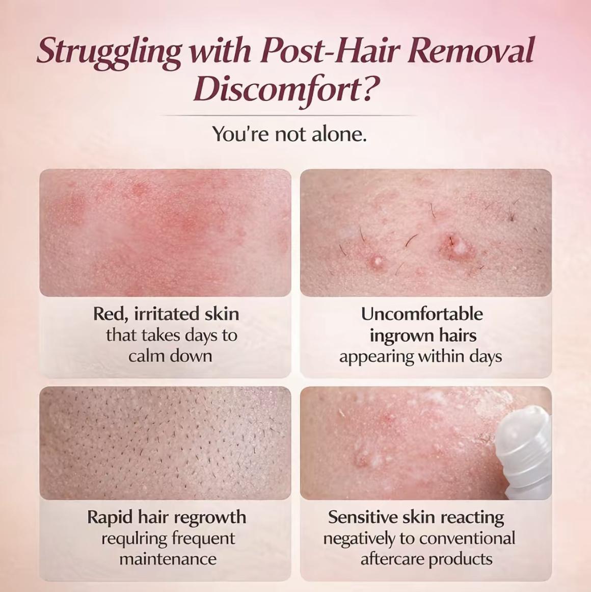 Post Hair Removal Skin Concerns