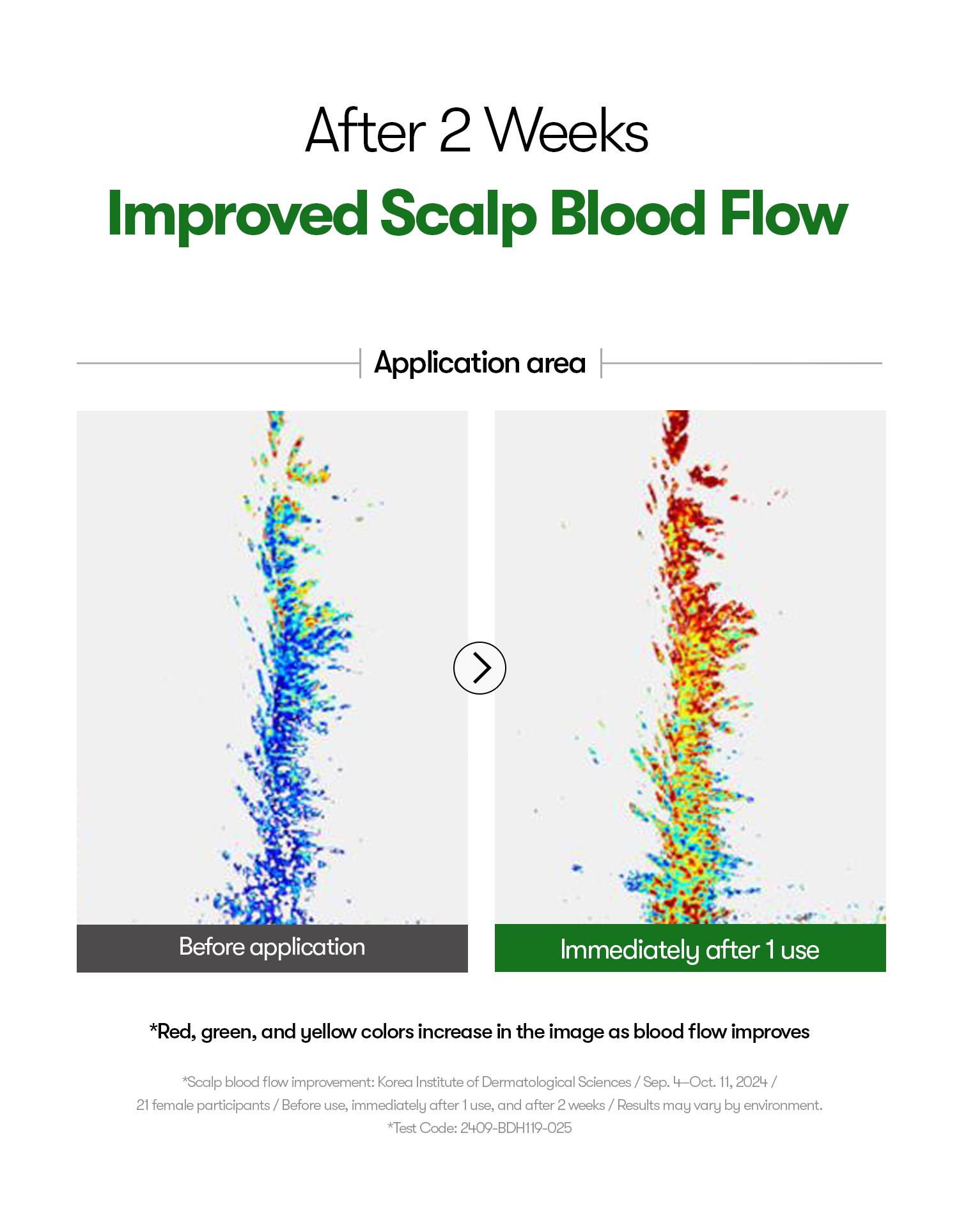 [VT Official] PDRN Reedle Shot Hair Ampoule | Hair Growth Hair loss treatment, Hair Loss Prevention, Scalp Health, OG Liquid Microneedling Reedle Shot, Enhanced Absorption Hair Serum Shot, PDRN & Caffein & Biotin & Rosemary Extract, Anti-aging Scalp No Ri