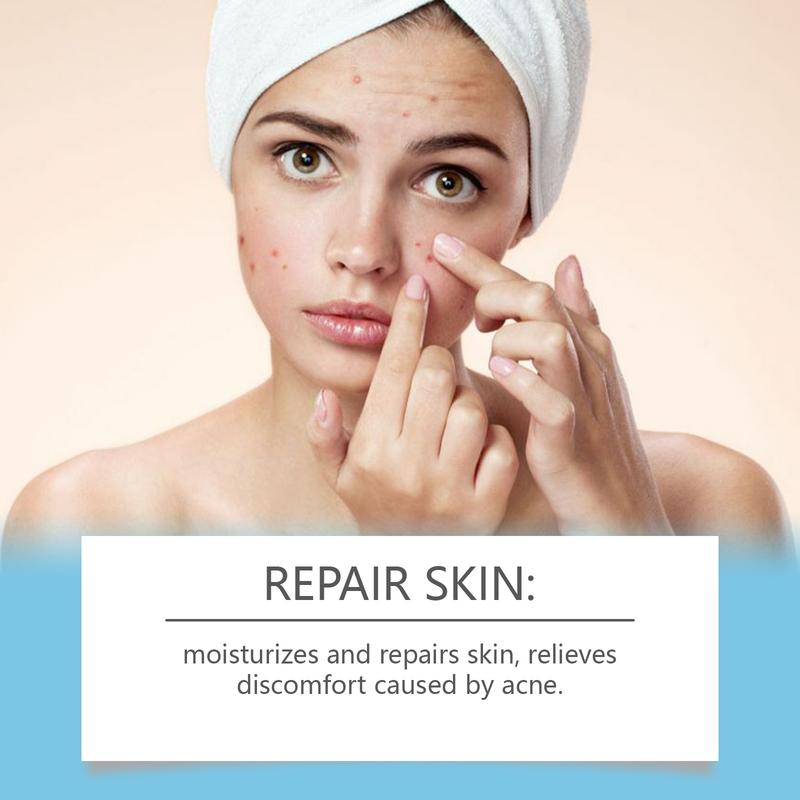 SOUTH MOON Skin Cream Helps Remove And Improve Skin Blemishes Gentle And Comfortable Controls Oil Secretion