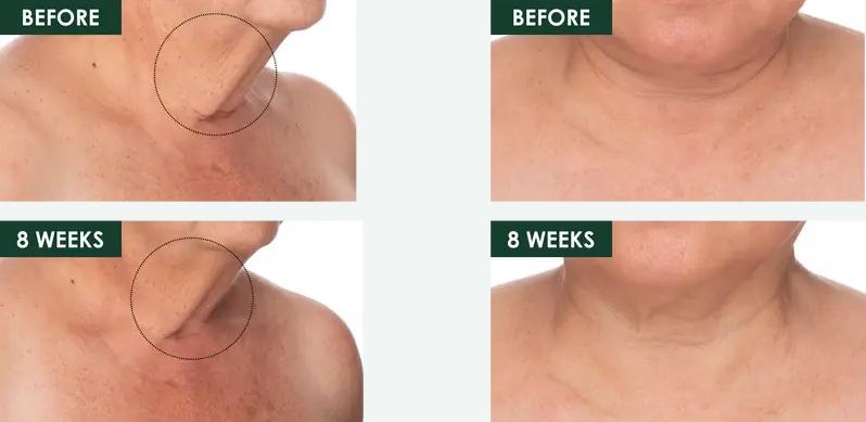 RéVive Fermitif Neck Renewal Serum / Firming Treatment - Restores Skin's Elasticity, Smooth Fine Lines & Boost Collagen - Enriched with Signature Bio-Renewal & Bio-Firming Peptides, Includes Dual Ended Applicator Brush (50 ml/1.7 oz)