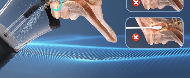 Morfone Electric Ear Wax Removal Rechargeable Water Spray with Temp Detection 4 Pressure Levels IPX6 Waterproof Deep Ear Cleaning System Earwax Remover Black