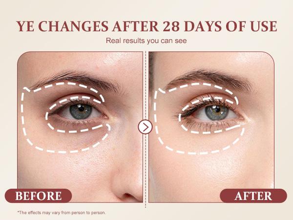 YCZ Dual-Extraction Caffeine Firming Eye Mask 60 Pieces | Target Puffiness, Dark Circles & Fine Lines for Smoother, Brighter Under-Eye Skin