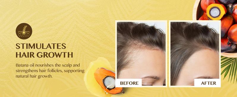 Raw Batana Oil for Hair Care: 100% Pure - Dr. Sebi Batana Oil from Honduras - For Thicker & Stronger Hair Men & Women 4.2 OZ Haircare Comfort