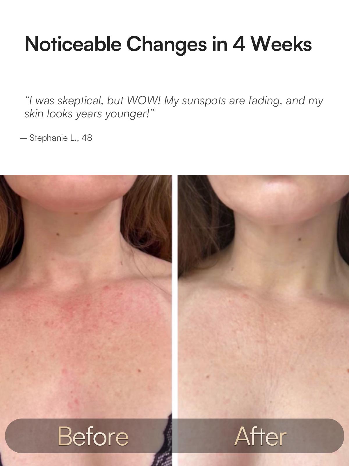 INIA GLOW Neck & Chest Red Light Mask – 850nm NIR | Fade Wrinkles & Spots | Lift & Firm in 4 Weeks - Red Light Skincare Device with 2600mAh Rechargeable Controller, Clinic-Grade, Full Coverage