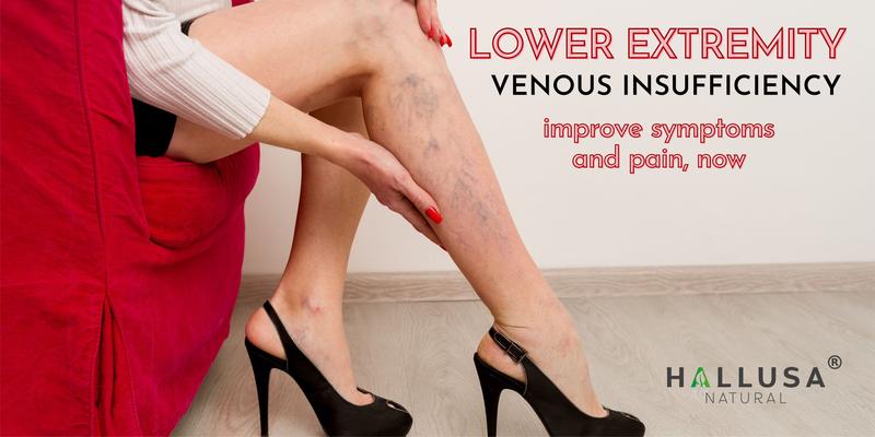 HALLUSA NATURAL HALLOSMINE 300 Mg Diosmin Circulation 60 Capsules Gluten-Free Organic GMO-Free Sugar-Free Supplement for Healthy Circulation & Veins Health Made in USA Dietary