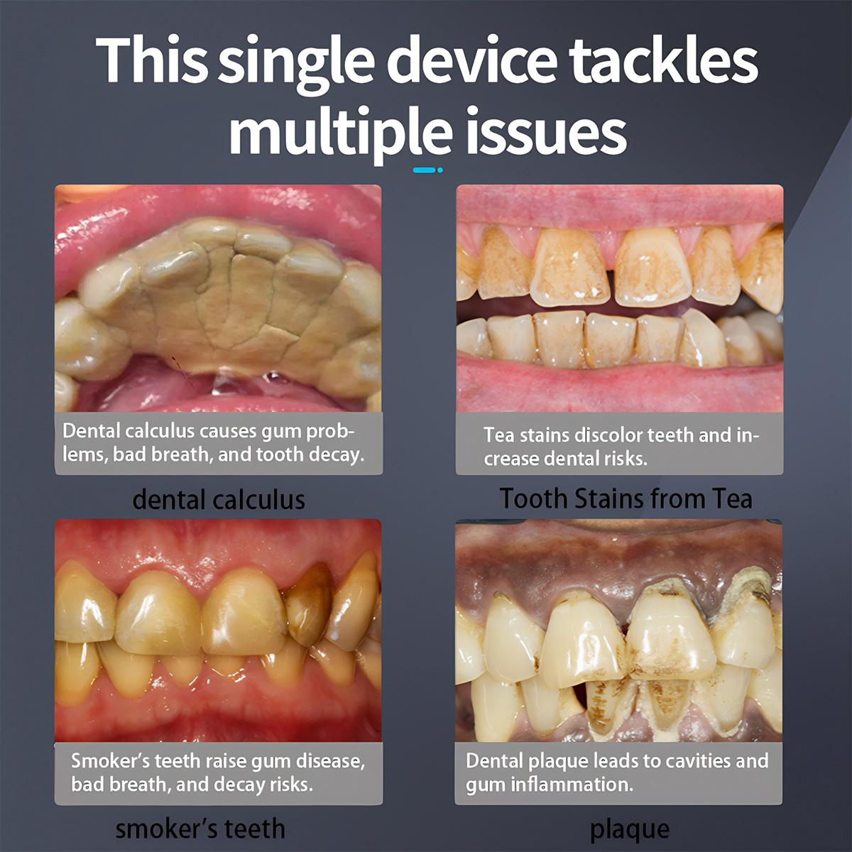 Plaque Remover for Teeth,Tartar Remover for Teeth Cleaning with 3 Replaceable Heads and 5 Adjustable Modes,Rechargeable Teeth Cleaning Plaque Remover for Home