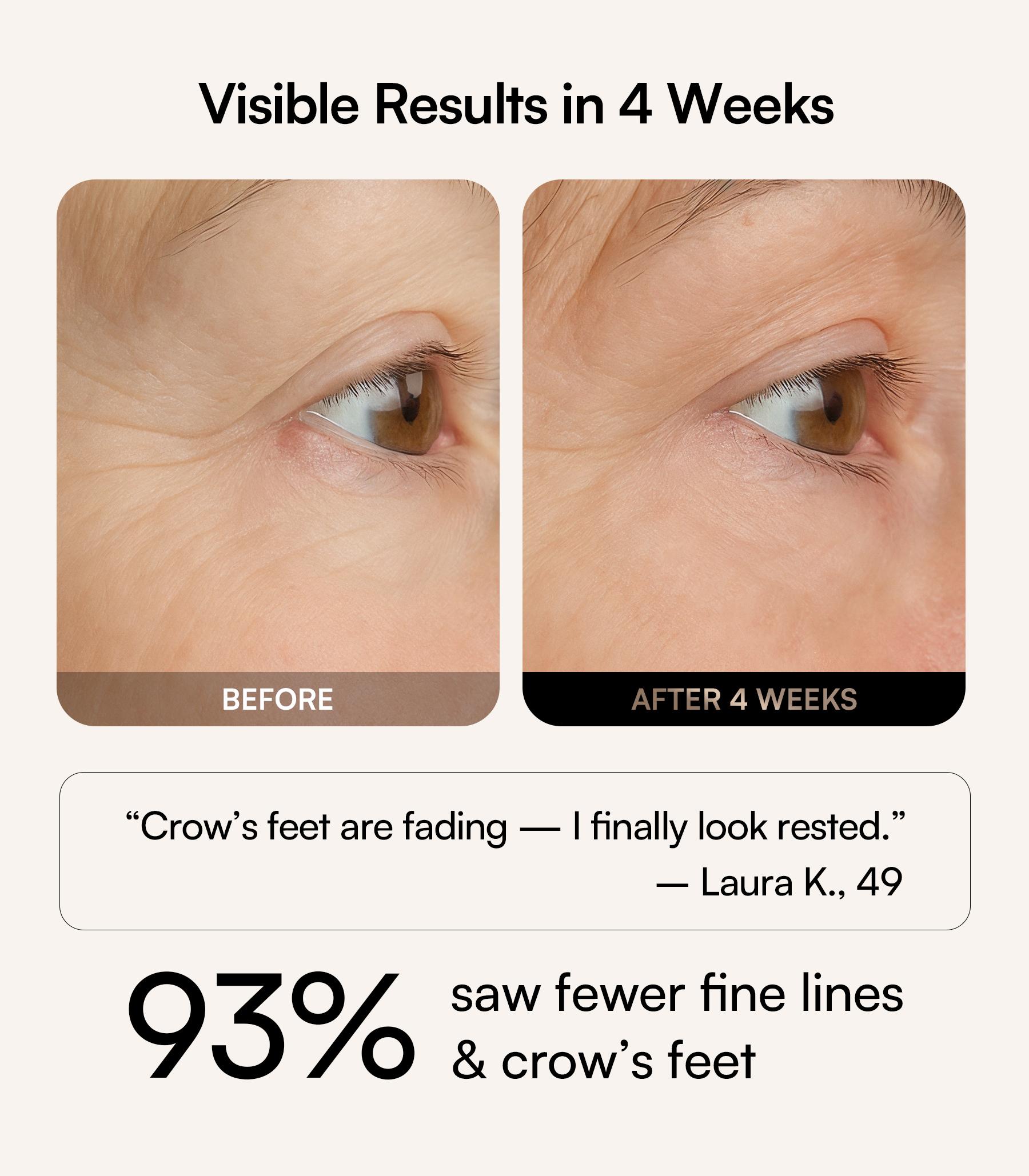 【LIVE EXCLUSIVE】INIA GLOW Red Light Therapy Eye Mask with 96 High-Density LEDs & Cryotherapy Cooling, LED Eye Mask Skincare for Wrinkles, Dark Circles & Puffiness, FDA-Cleared, Portable and Rechargeable, 2-Year Warranty