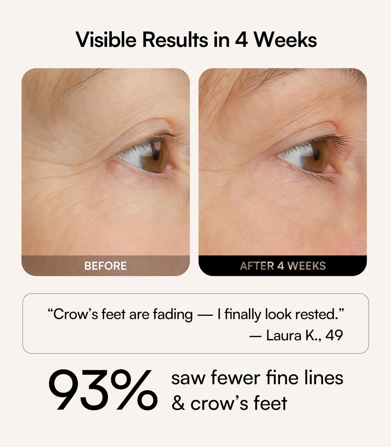 【LIVE EXCLUSIVE】INIA GLOW Red Light Therapy Eye Mask with 96 High-Density LEDs & Cryotherapy Cooling, LED Eye Mask Skincare for Wrinkles, Dark Circles & Puffiness, FDA-Cleared, Portable and Rechargeable, 2-Year Warranty