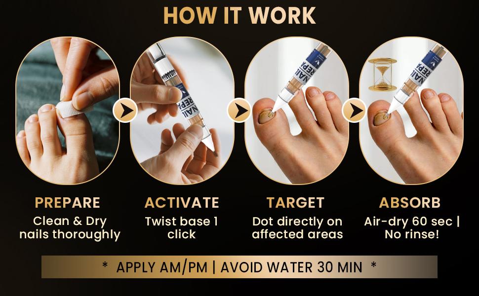 VecNythra Pen 25% Undecylenic Acid Helps Support Stronger Healthier-Looking Nails