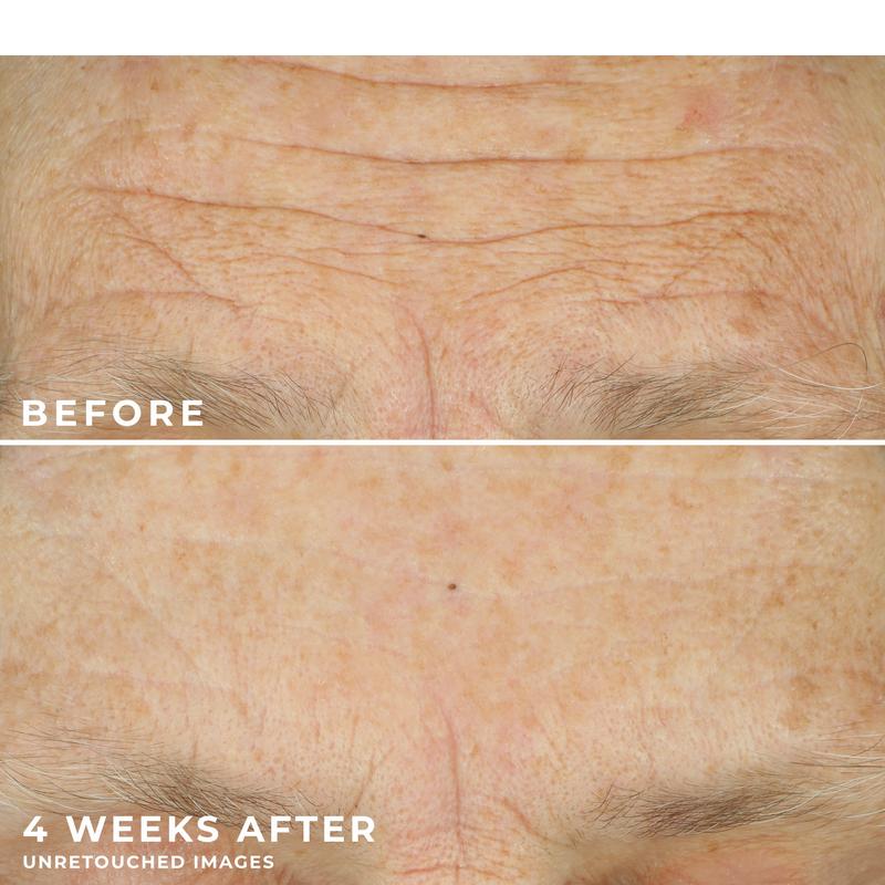 MULTI CORREXION® Crépe Repair Face & Neck Cream MULTI CORREXION® Crépe Repair Face & Neck Cream