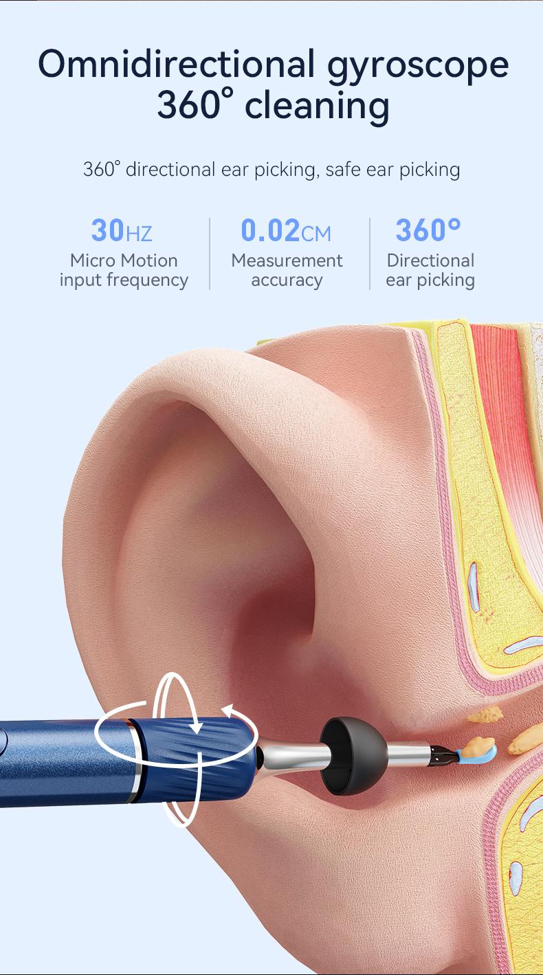 Ear Wax Removal Kit with Camera and Tools - Otoscope Ear Cleaner with Flexible HD Scope, Visual Ear Pick Tweezers Wax Remover, Safe Cleaning for Adults Kids Ear Wax Removal Kit with Camera and Tools - Otoscope Ear Cleaner with Flexible HD Scope, Visual Ear Pick Tweezers Wax Remover, Safe Cleaning for Adults Kids