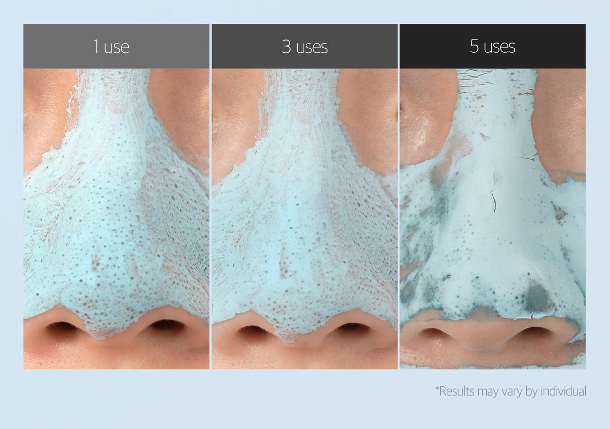 [medicube] Zero Pore Blackhead Mud Mask |  3 min mud mask |  pore care | Strong Blackhead Absorption |