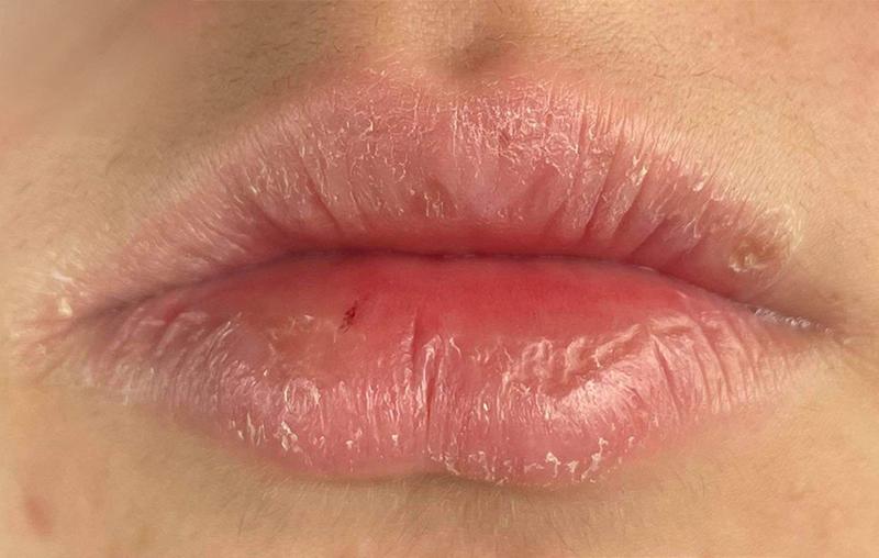 The Original 101 Ointment Multipurpose Superbalm – Ultra-Hydrating Lanolin Balm for Lips & Skin, 9g / 15g