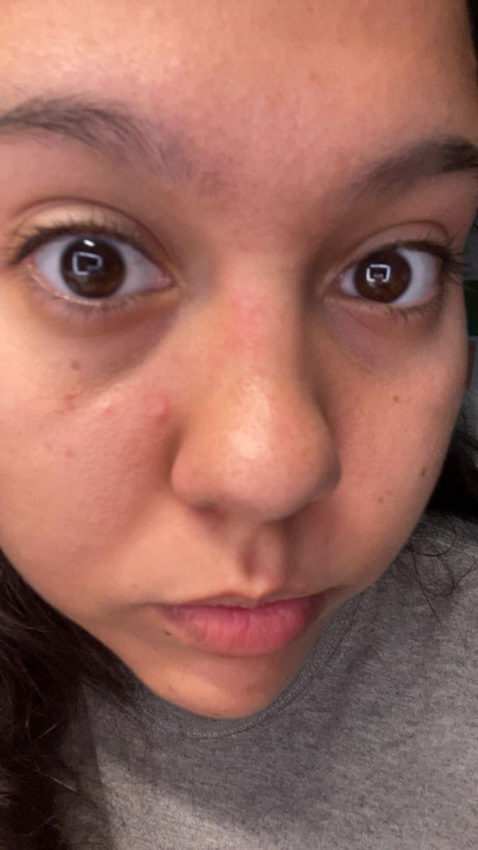 Item: Black Rice Peeling Ampoule + Body Peeling Spray