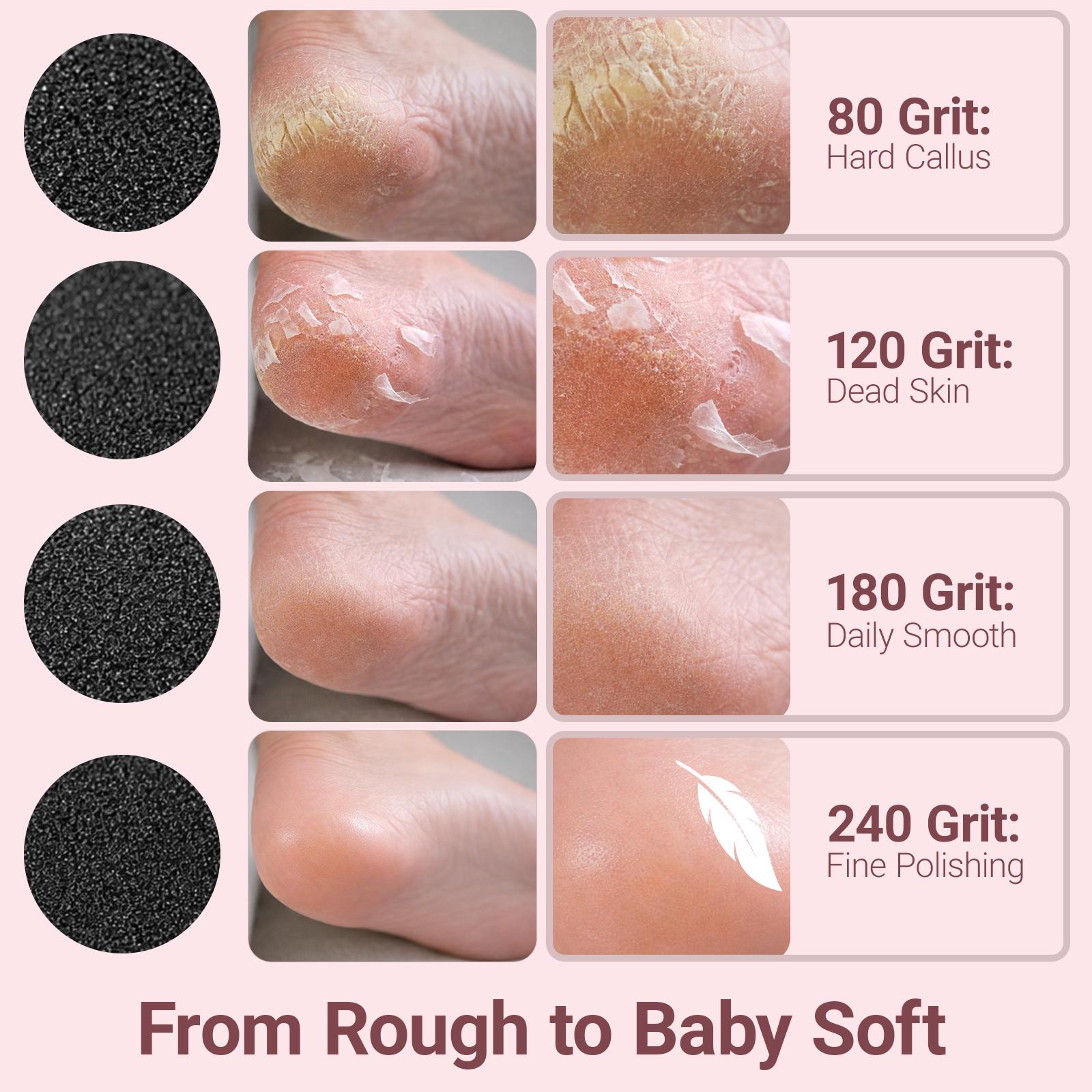 Professional Electric Foot File Scrubber with 40 Replacement Discs ...