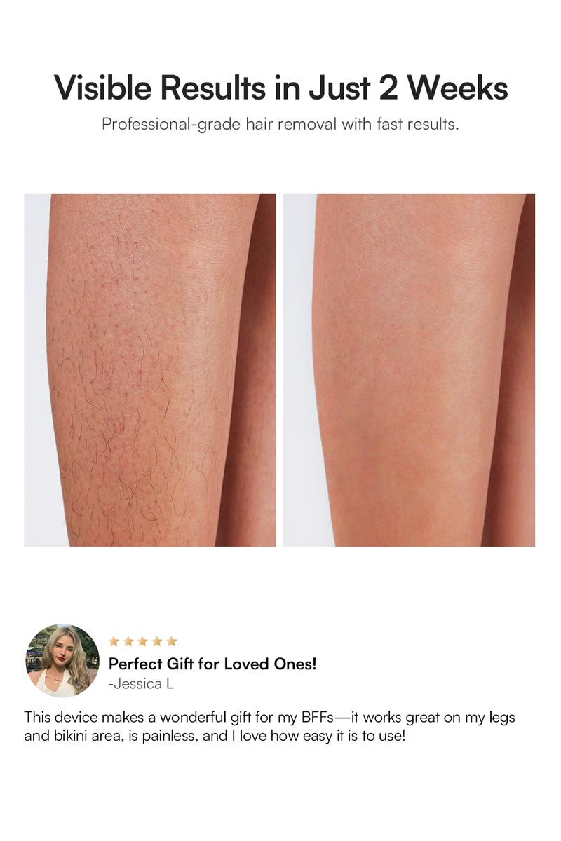 【LIVE EXCLUSIVE】INIA HAUTE Pro Sapphire Ice-Cooling IPL Hair Removal Device – Painless, FDA Cleared, Full Body & Bikini Use, Long-Lasting Results for Women & Men, 2-Year Warranty – Stay Cool & Smooth This Summer