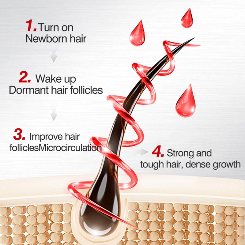 QINGLIN Hair Growth Serum - Anti Hair Loss Treatment, Scalp Nourishing Essence, Strengthens Roots & Promotes Thicker Hair (US Stock)