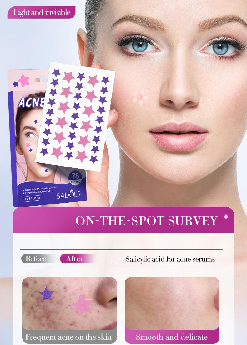 【156PCS】Star Shaped Hydrocolloid Acne Patch,Suitable for All Skin Types,Waterproof Acne Cover Patches, Repair and cover acne blemishes,Blemish Patches,Alcohol-Free Sensitive