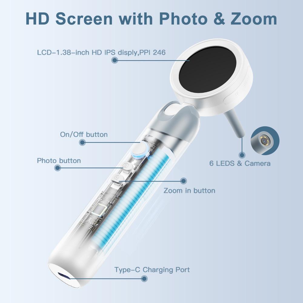 【2026 Upgrade】Aspoven Digital Otoscope with LED Light, 1.4" IPS Screen, 1080P HD Ear Scope for Kids, Adults & Pets, 12 Silicone Specula Tips, Photo & Video Recording, Type-C Rechargeable Ear Wax Removal Tool