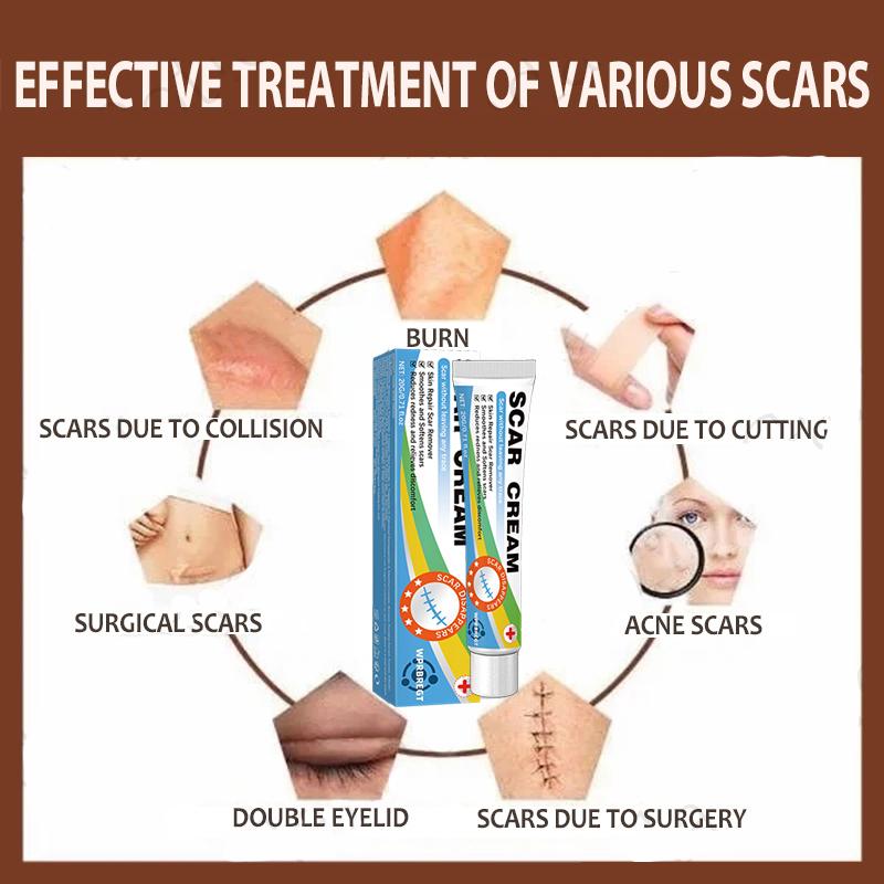 Scar Removal Cream & Gel for Effective Scarring Reduction - Fades Surgical & Acne Scars, Promotes Cell Regeneration, Lightweight Texture, Suitable for All Skin Types