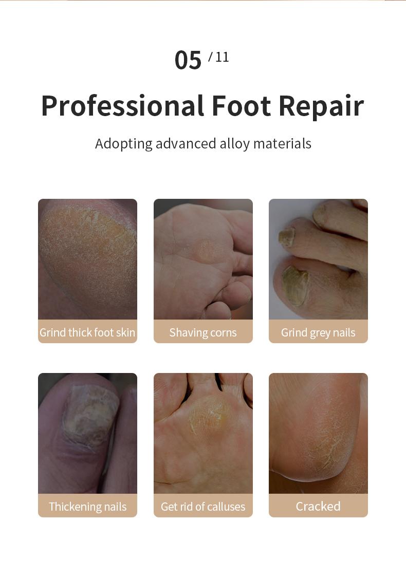 Electric Feet Callus Remover,Portable Electronic Foot File Pedicure Tools,Waterproof Foot Scrubber File,Pedi Foot Care for Dead,Hard Cracked Dry Skin Manicure Nail Nail Care Cutics Nail Art