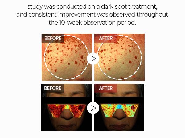 [Dr.Melaxin Official] TX Tranexamic Acid Dark Spot Care Line | TX Ampoule Cleanser + Peeling Toner + Ampoule Rx + Cream | Dark Spot, Brightening