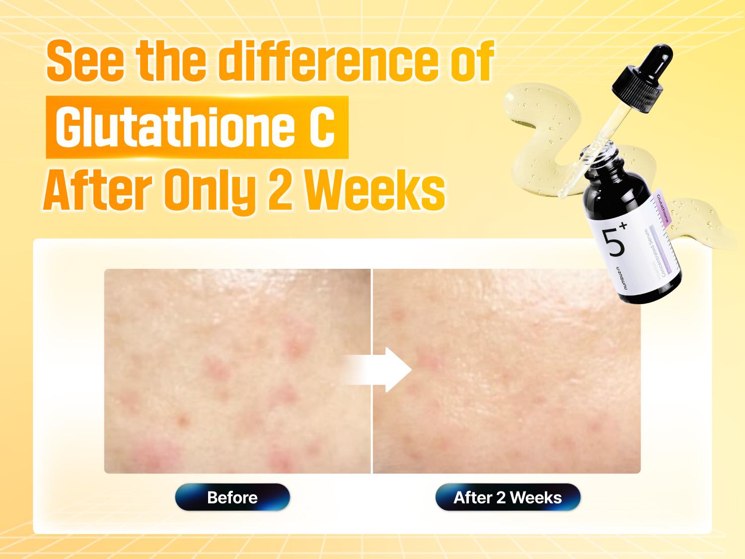 [numbuzin official shop] No.5 Serum | Vitamin Concentrated Serum | Tranexamic Acid 4%, Niacinamide 5%, Glutathione, Vitamin C | Hyperpigmentation | 1.01 fl. oz.